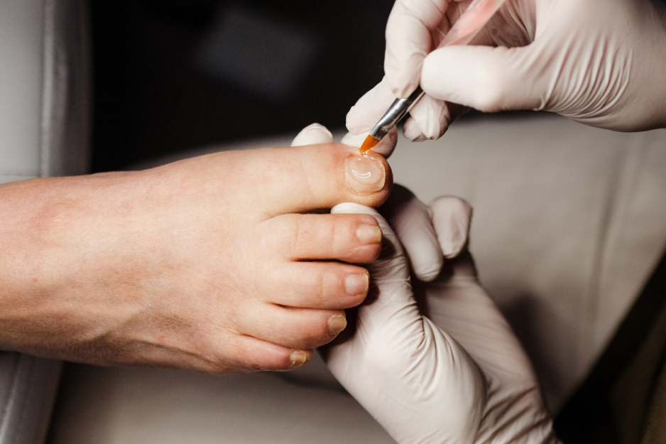 voetenspecialist-miranda-nagelreparatie