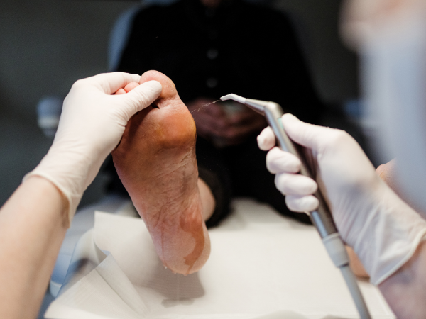 voetenspecialist-miranda-pedicure-behandeling-reumatische-voeten