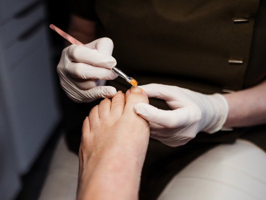 voetenspecialist-miranda-nagel-behandeling