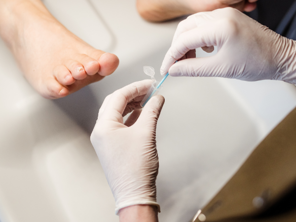 voetenspecialist-miranda-pedicure-behandeling-funghi-check