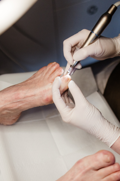 voetenspecialist-miranda-nagelreparatie